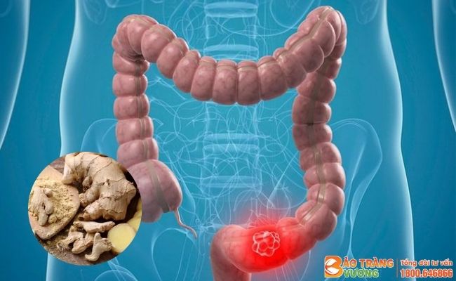 Can khương chống co thắt đại tràng, kháng viêm, diệt khuẩn tốt