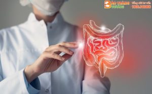 Điều trị viêm đại tràng bằng cách nào mang lại hiệu quả cao?
